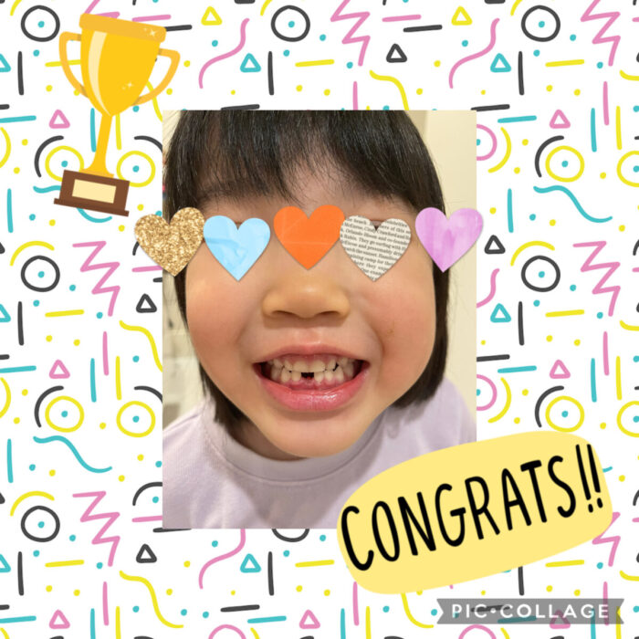 歯が抜けました✨